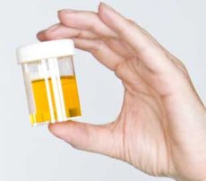 A hand holding a urine sample