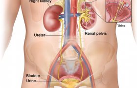 Blood in urine Bladder cancer