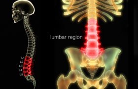 Severe Back pain Causes