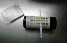 Test for blood in urine
